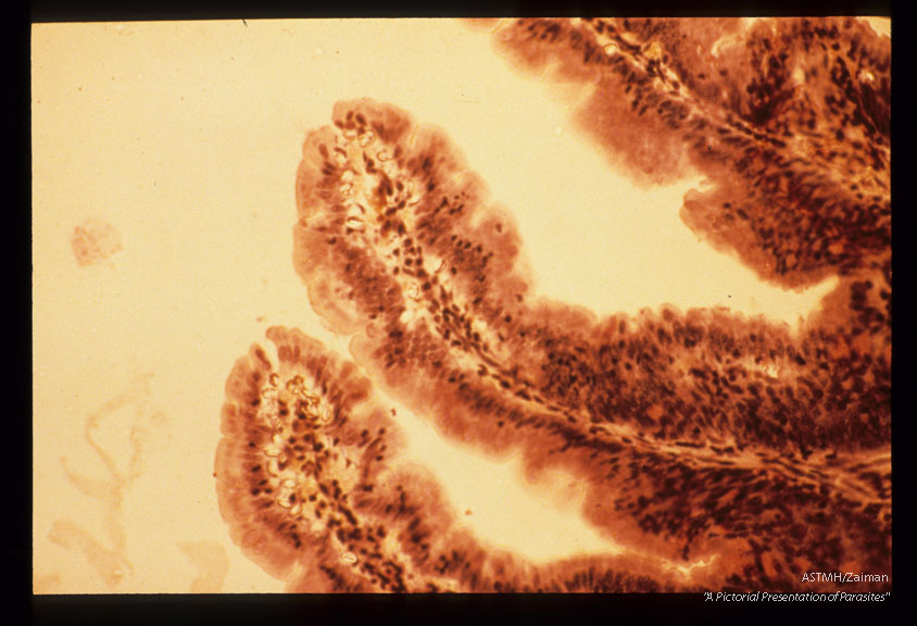Sporocysts in submucosa of definitive host (oppossum) small bowel. H & E.