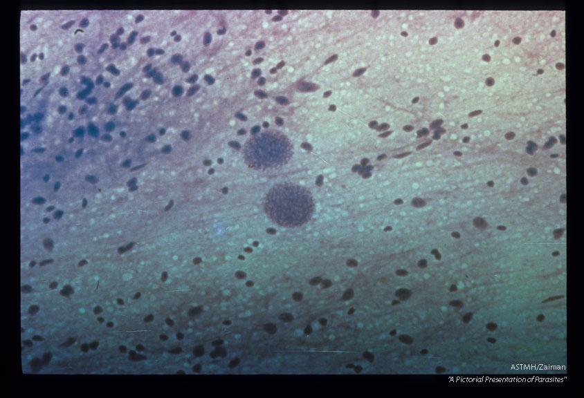 Young cysts in brain smear from bank vole (Clethrionomys glareolus). Giemsa stain.