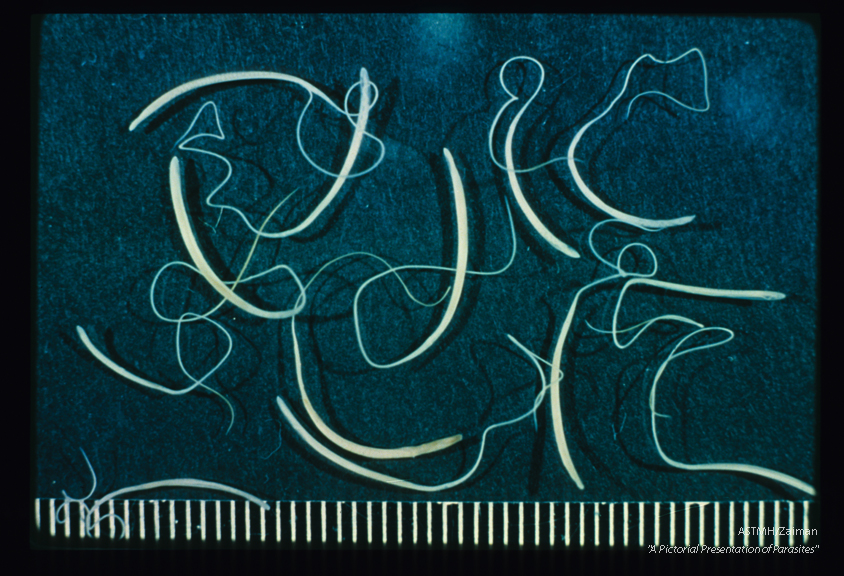 Several adult females are shown. Note the thick posterior and thin anterior portions of the worms which simulate a whip handle and lash.