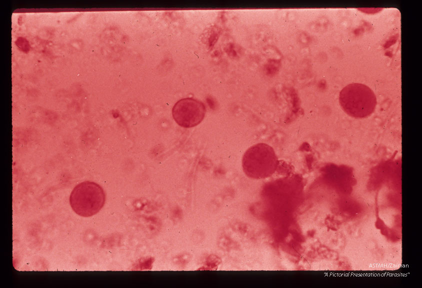 Iodine stained cysts in stool showing different numbers of nuclei.