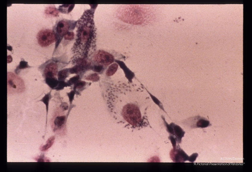 Hela cell culture infected with Peru strain.