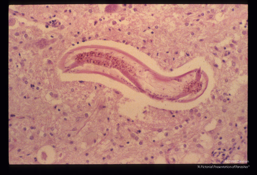 Larva in rabbit cerebrum.