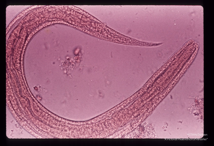 Rhadbitiform larva in stool.
