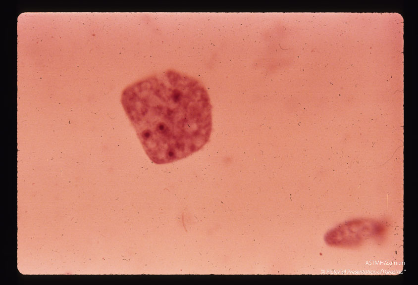 Multinucleate culture form. Hematoxylin stain