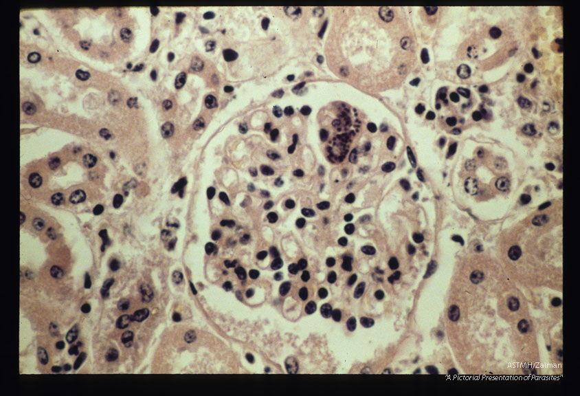 ( = Sarcocystis cruzi, = Sarcocystis fusiformis). Schizont in endothelium of bovine kidney glomerulus.