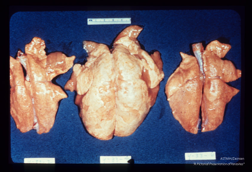 Mouse lungs showing the cumulative effect of concomitant infection with ascarids and a pneumonic virus. The laterally placed lungs have been subjected to either Ascaris or virus; the central lung suffered both infections.