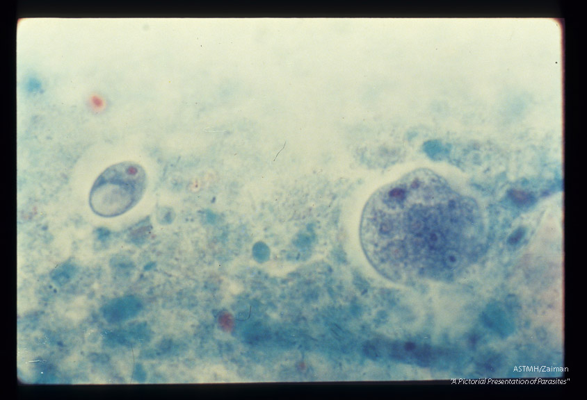 Cysts in stool. Trichrome stain.