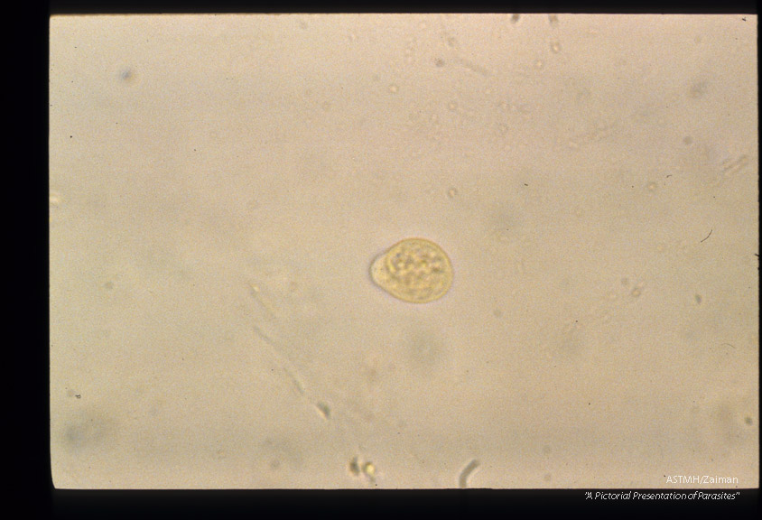 Uninucleate lemon shaped cyst, iodine stained.