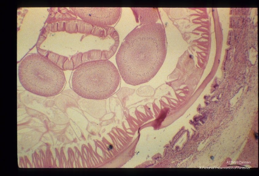 Cross section of adult in bile duct.