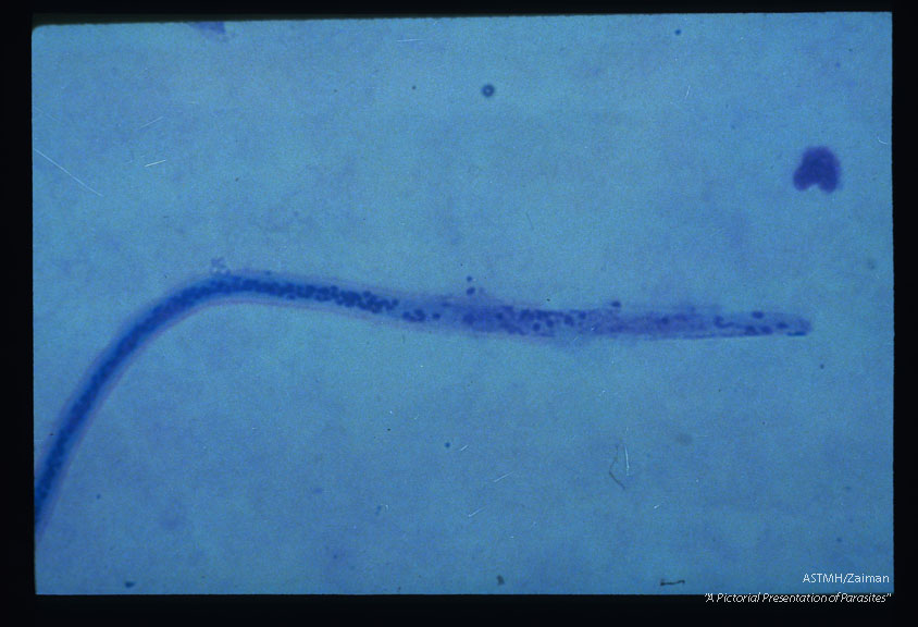 Giernsa stained damaged larva from A. gambiae midgut.