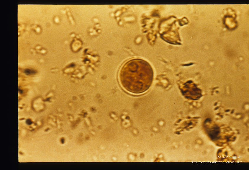 Cysts stained in iodine. Recovered from W.V.U. medical student who had visited and worked in Turkey.