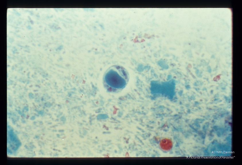 In stool. Trichrome stain.