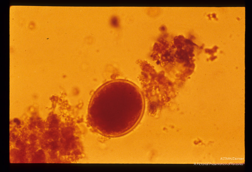 Decorticated egg. Iodine stained.