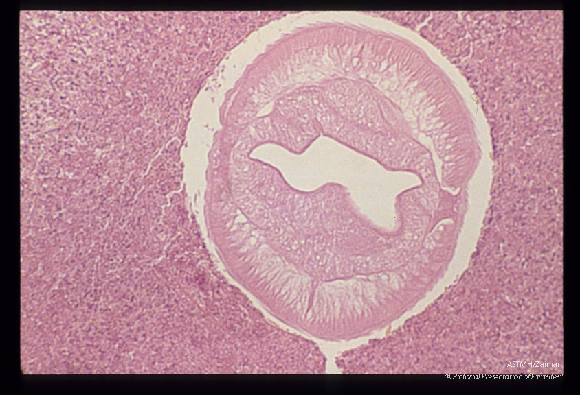 Cross section through worm in stomach wall.
