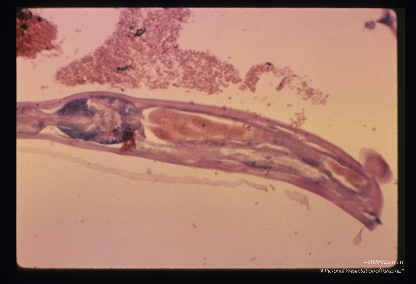 Longitudinal section of the gut containing blood.