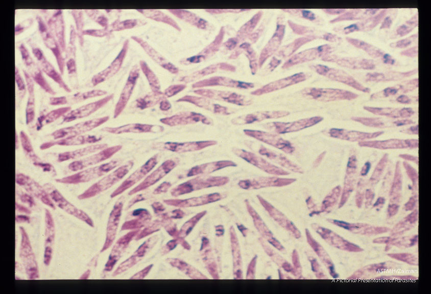 Zoites from the muscle of a duck (stained. 1316 and biphase microscopy, 1317).