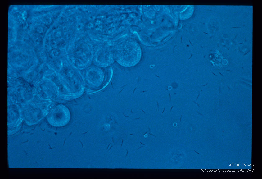 Oocysts and sporozoites on and near th midgut of Culex pipiens pipiens.