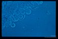 Oocysts and sporozoites on and near th midgut of Culex pipiens pipiens.