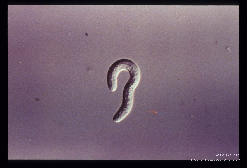 Newborn larva. Nomarski optics.