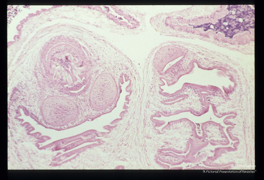 Multiple sections showing membranes, suckers and hooks.