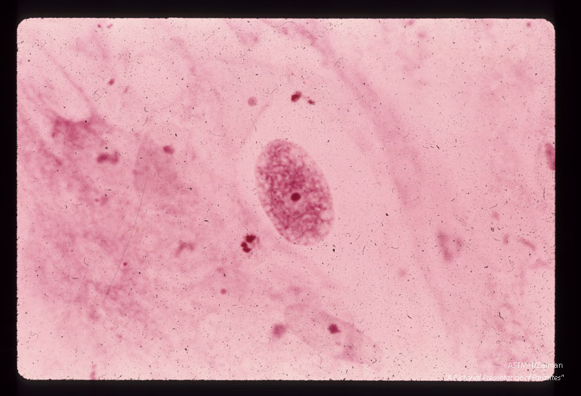 Mature macrogametocyte. The central karyosome is clearly visible and the plastic granules appear as vacuoles at the periphery. Methyl green-toluidine blue stain. (168 hr).