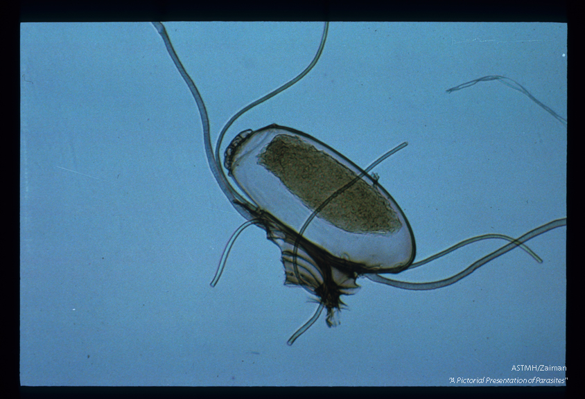 A louse egg (nit) attached to hair.