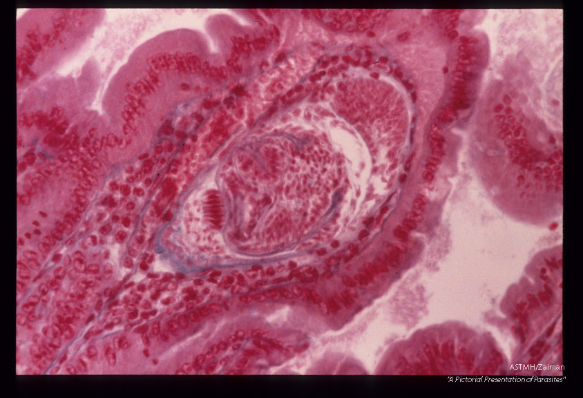 Cysticercoids in villi of a mouse.