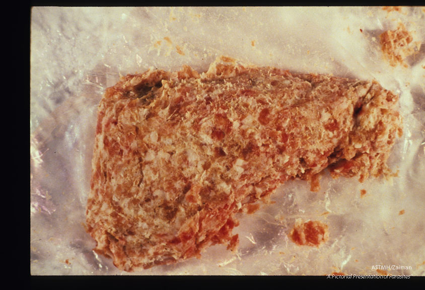 Infected pork sausage which produced human infection.