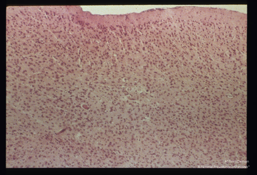 Hematoxylin-eosin stained sections of infected mouse brain.