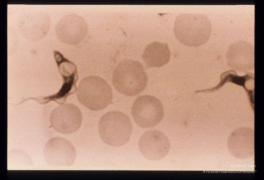 SAK strain in infected mouse blood, showing post-nuclear vacuoles.