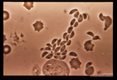Tachyzoites, free and in macrophages from peritoneal fluid of mouse. Phase, unstained.