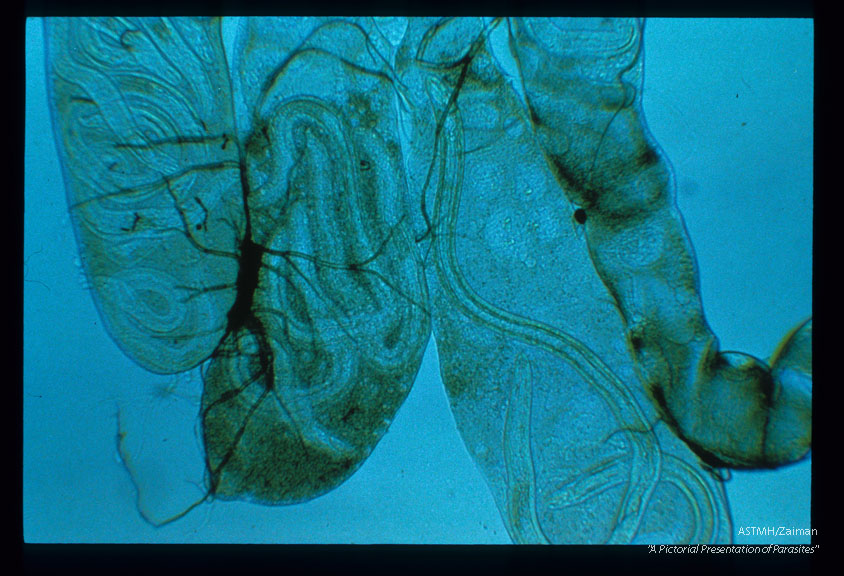 Phase contrast micrographs of developing larvae within the Malpighian tubules of A. trivittatus.