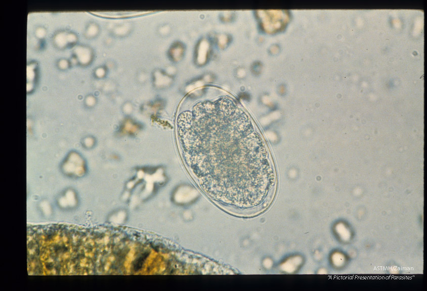 Sequence showing development of larva in egg.