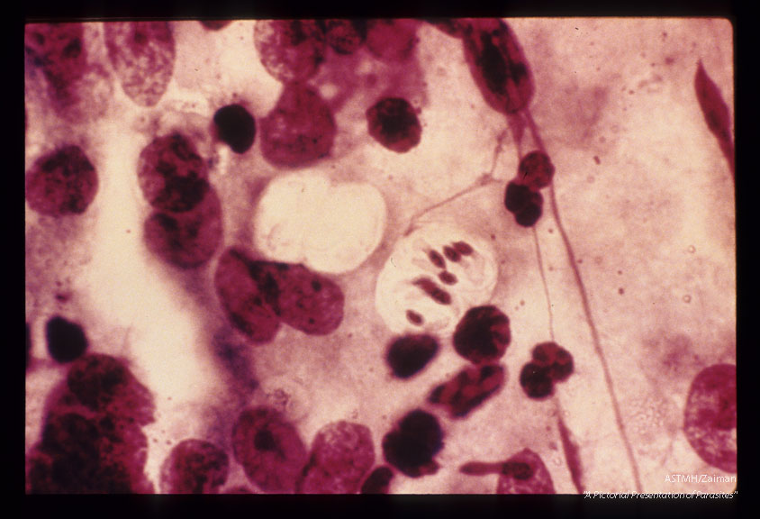 Sporulated oocysts in lamina propria of an opossum bowel.