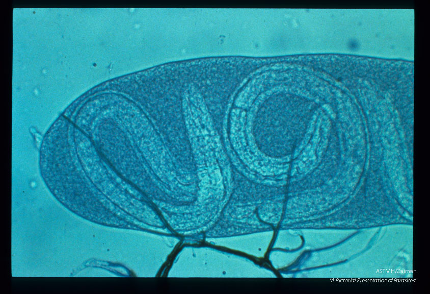 Phase contrast micrographs of developing larvae within the Malpighian tubules of A. trivittatus.