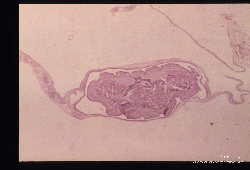 Nymphs in mesentery.