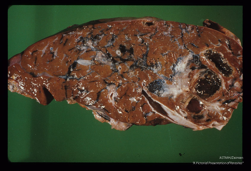 Infected bovine liver.