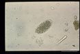 Egg from human stool. Characteristically this egg is longer than hookworm eggs.
