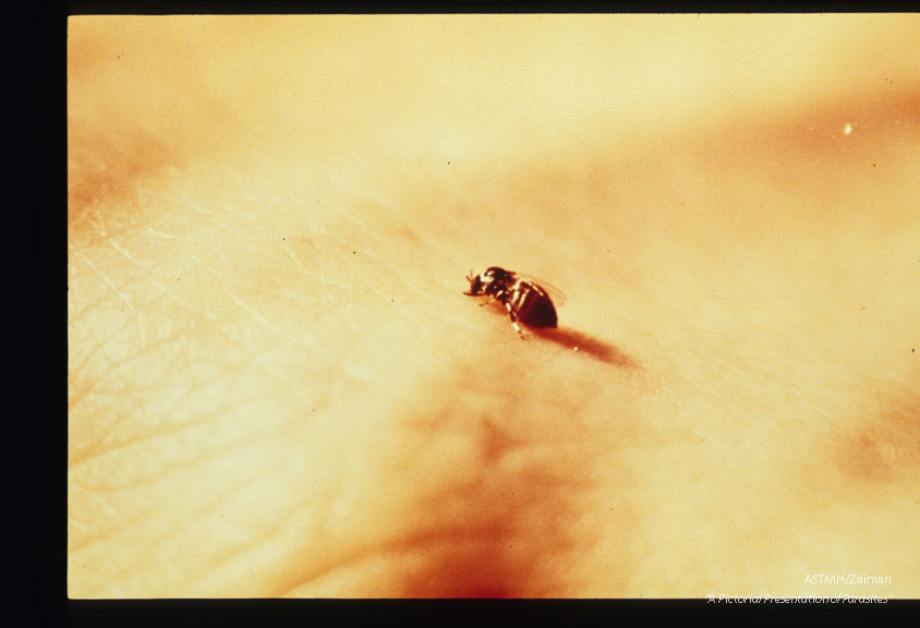 Fly feeding on man.