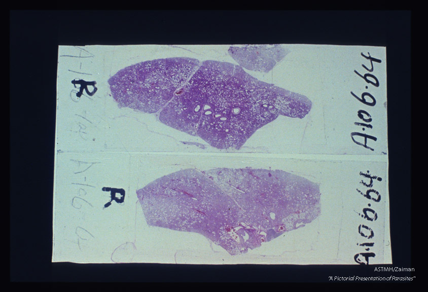 Sections through lungs of experimentally infected rats showing infiltration in hilar, peribronchial and subpleural areas where such infections usually start. The infection is not evenly distributed through the lung sections.