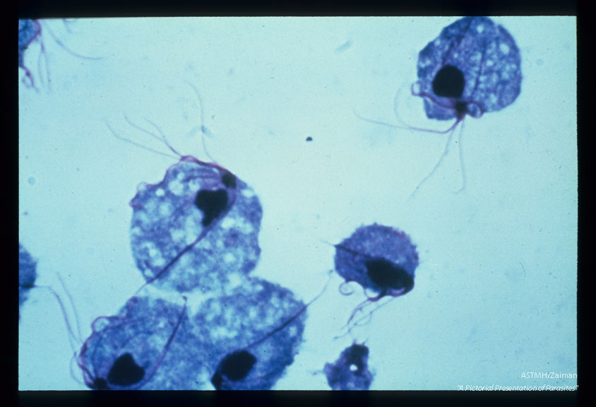 Hematoxylin stained organisms showing nucleus, axostyle, free flagella, and an undulating membrane.