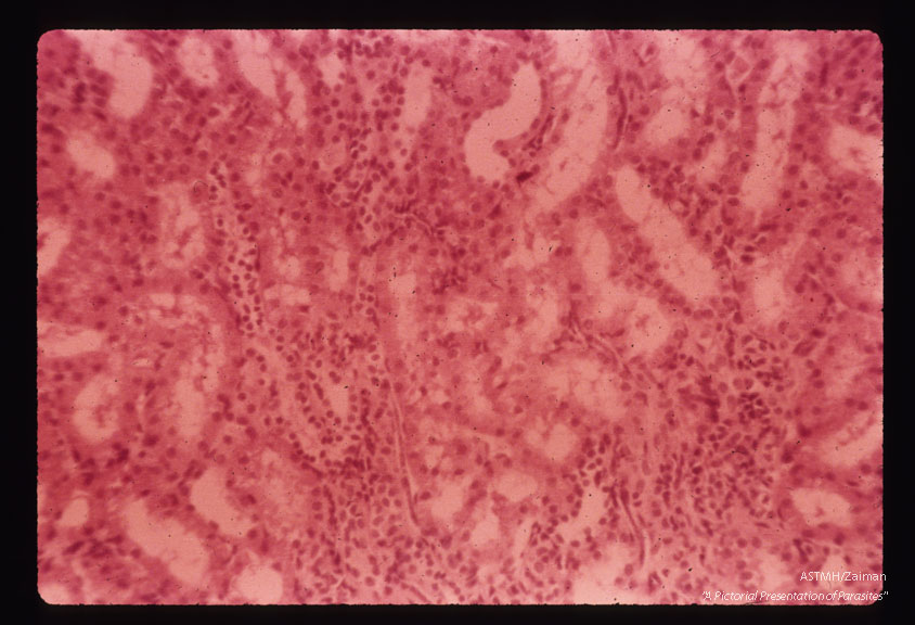 Microfilaria in dog kidney.