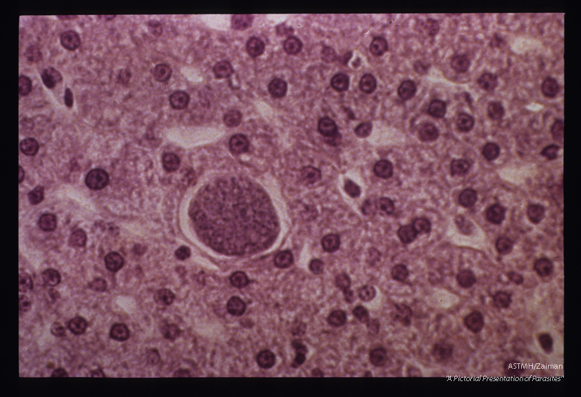 Exoerythrocytic stage in the liver of an experimentally infected monkey.
