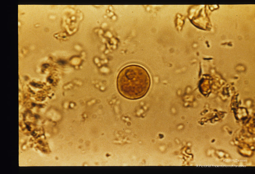 Cysts stained in iodine. Recovered from W.V.U. medical student who had visited and worked in Turkey.