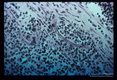 Larval forms invading sub-mucosa. Marked inflammatory response.
