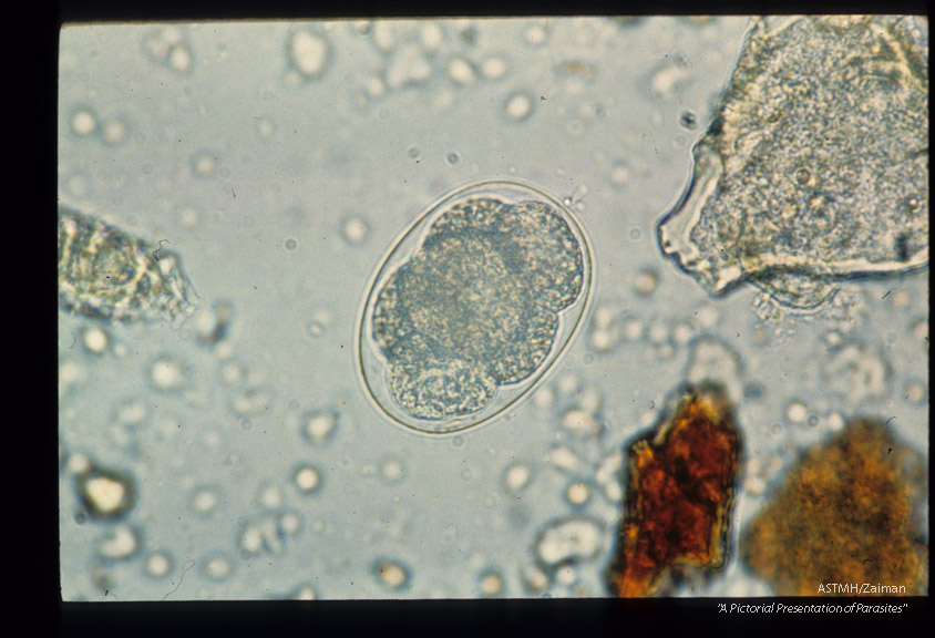 Sequence showing development of larva in egg.