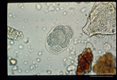 Sequence showing development of larva in egg.
