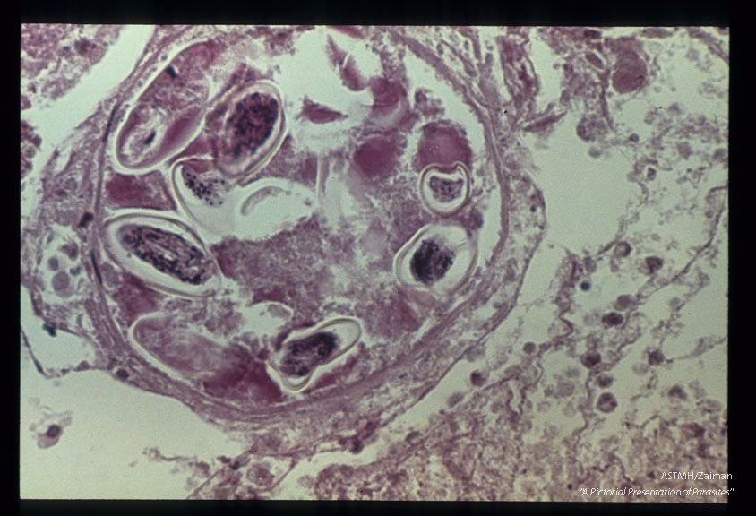 Cross section through uterus containing many typical plano-convex ova.