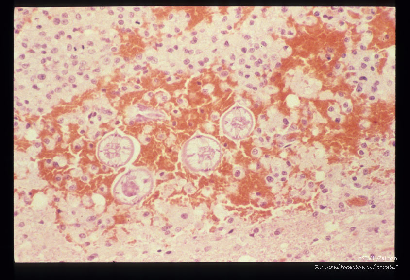 Experimentally infected squirrel monkey with larva in a hemorrhagic migration tract.