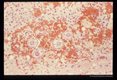 Experimentally infected squirrel monkey with larva in a hemorrhagic migration tract.